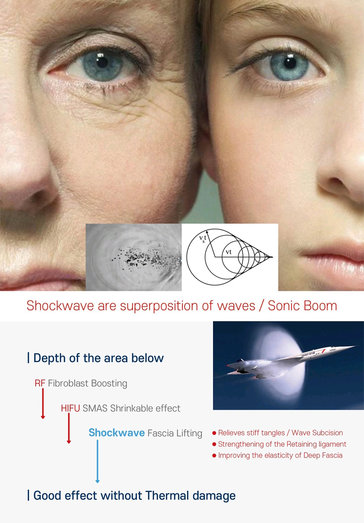 빠샤리프팅 브이친