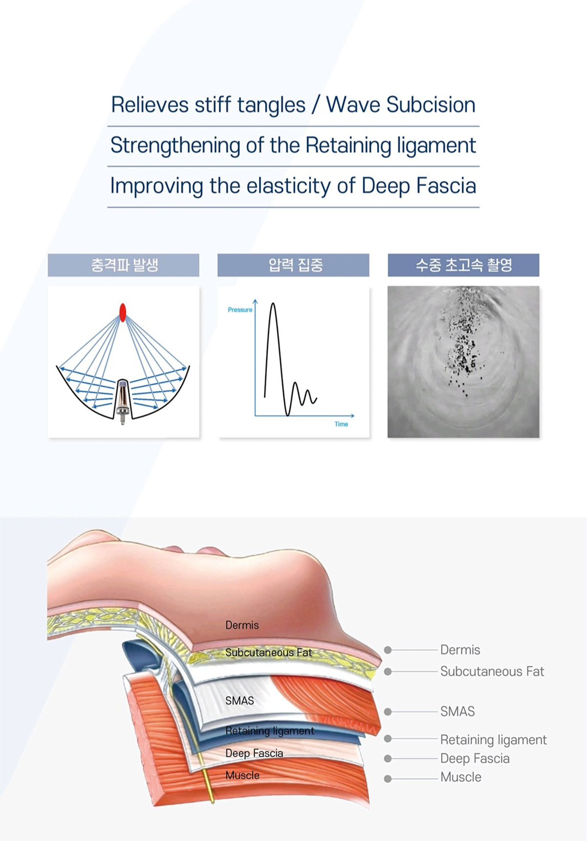 브이친 특허기술