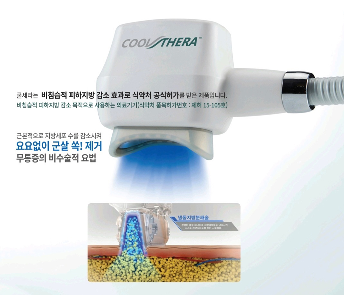 비만치료기 쿨쎄라